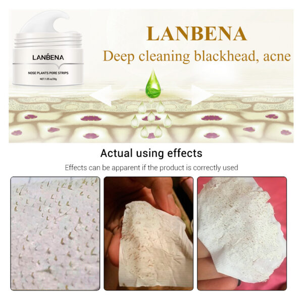 Blackhead Nasal Membrane Sucking Blackhead Tearing To Remove Acne - Image 10