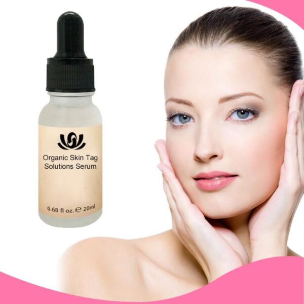Organic Tags Solutions Serum No Trace Painle Skin Tag Remover Serum Mole Removal Cream Painless Face Wart Mole Freckle - Image 6