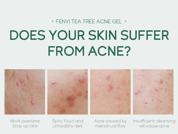 20g Moisturizing Skin Care Products - Image 10