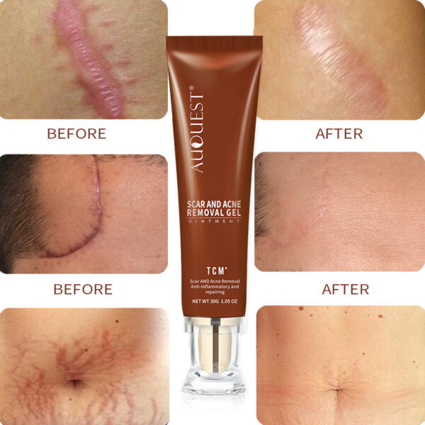 Moisturizing And Repairing Scar Skin Care Cream - Image 2