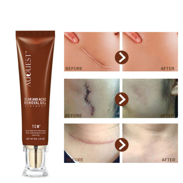 Moisturizing And Repairing Scar Skin Care Cream - Image 3