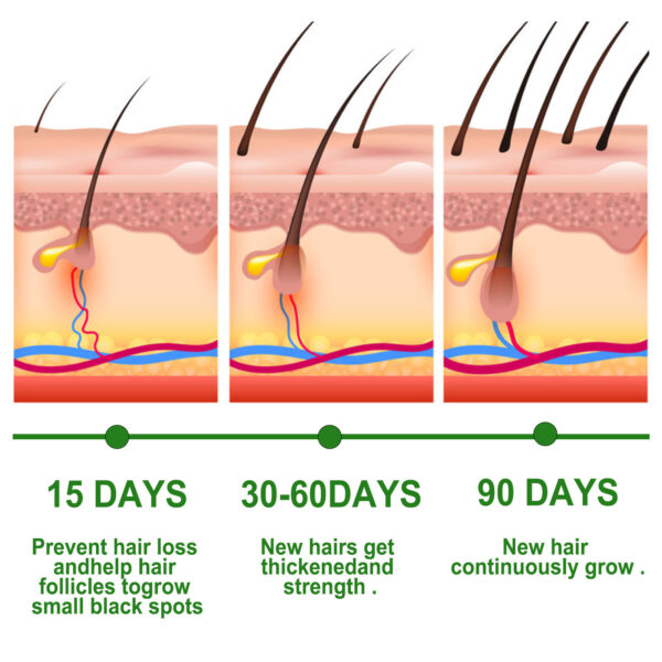 Rosemary Anti-Breakage Nourishing Hair Care Oil - Image 5