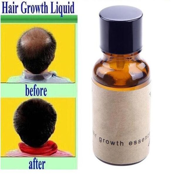 Hair growth liquid - Image 2