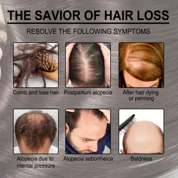 Rosemary Anti-Breakage Nourishing Hair Care Oil - Image 9