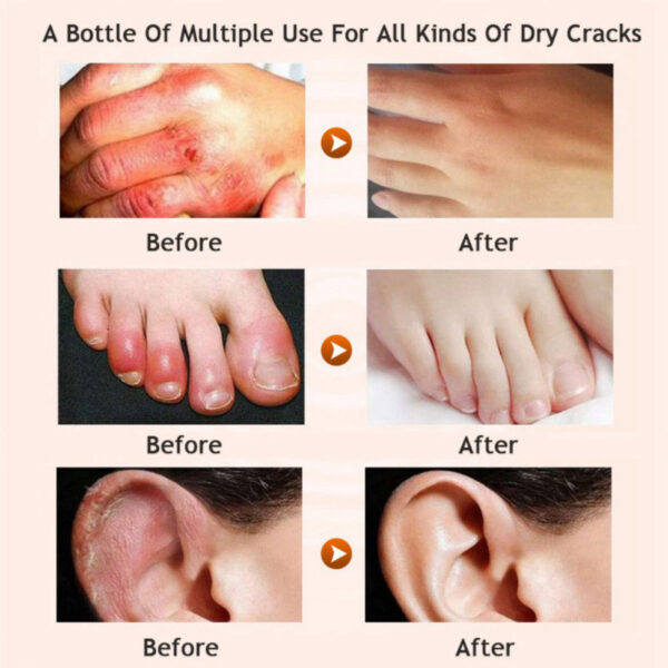 Honey moisturizing cream foot cream leg cream - Image 3