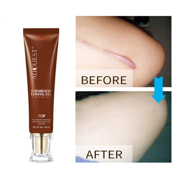Moisturizing And Repairing Scar Skin Care Cream - Image 5