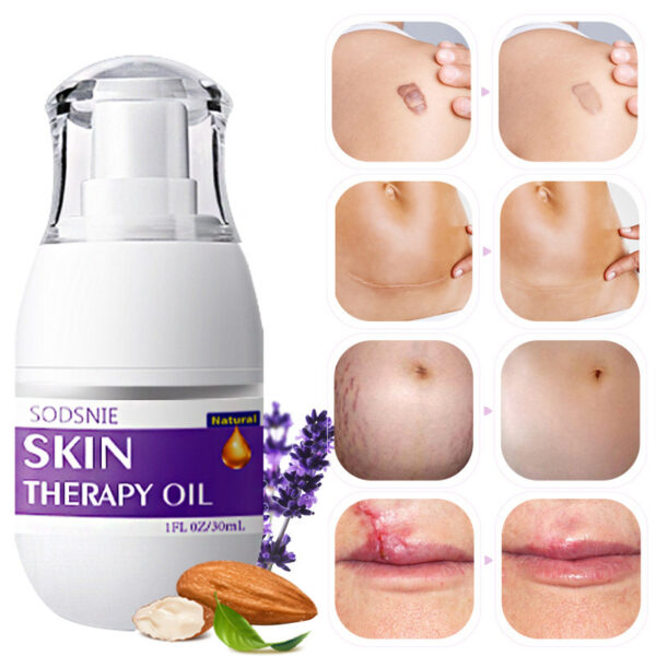 Skin Treatment Oil Remove Puncture Cellulite Stretch Mark Repair Body Care 30ml - Image 6