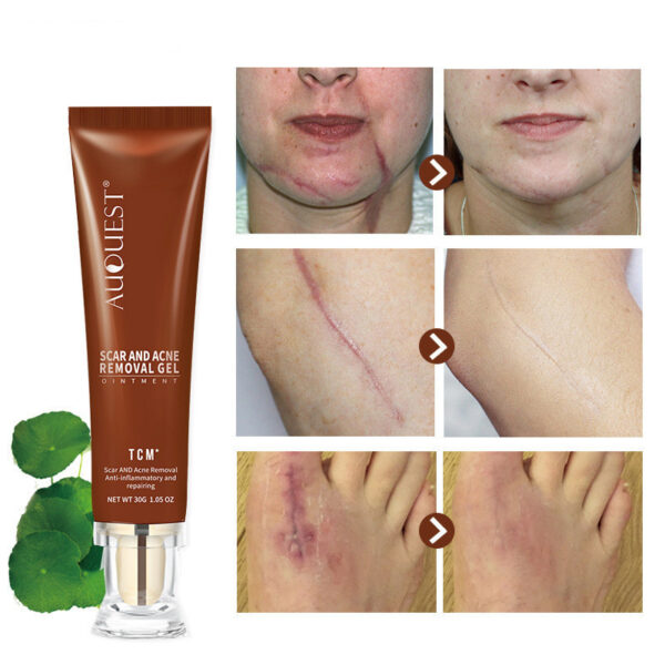 Moisturizing And Repairing Scar Skin Care Cream - Image 7