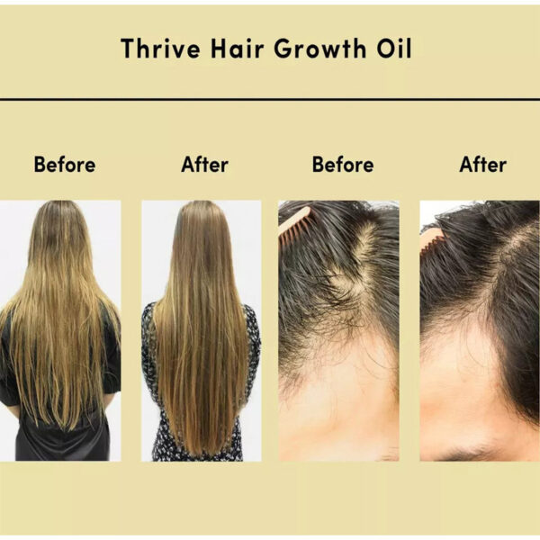 Hair Essential Oil Improve Dryness And Irritability And Nourish - Image 5